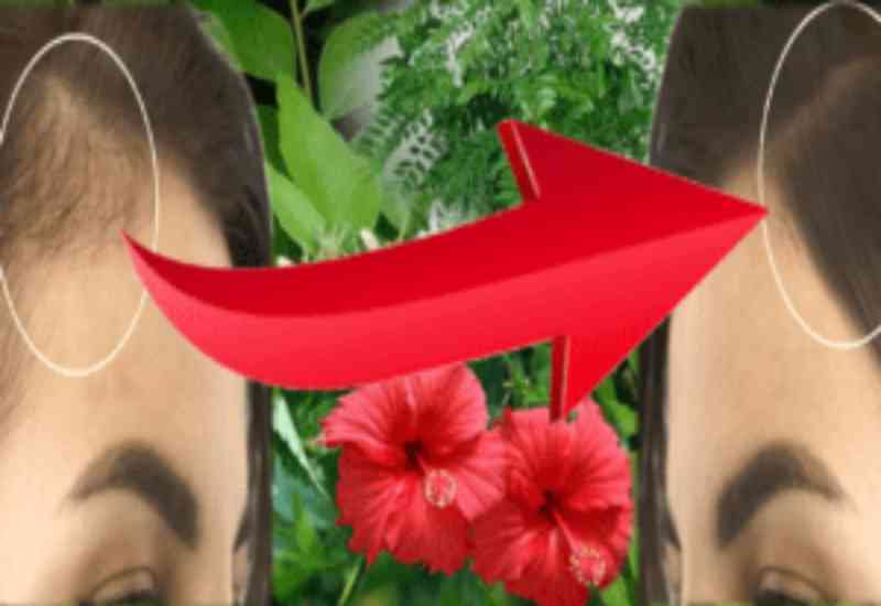 মাথার সামনের দিকে টাক? এই ৩ পাতার 'জাদুতে' বন্ধ হেয়ার ফল, গজাবে নতুন চুল!