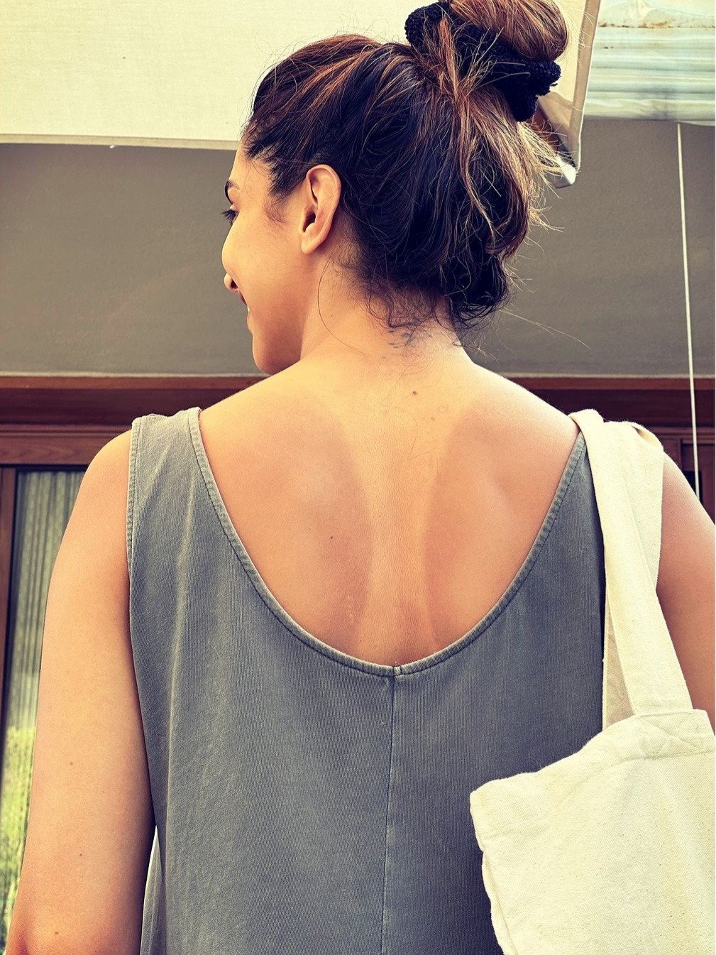 Burns on Deepika's back? What happened to the mother-to-be?