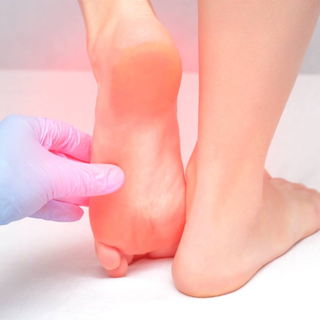 ইউরিক অ্যাসিড