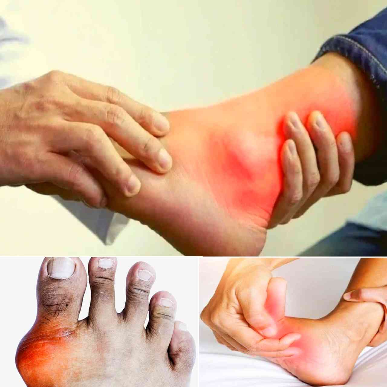 সকালের ৫ অভ্যাসেই জব্দ হবে ইউরিক অ্যাসিডের ব্যথা