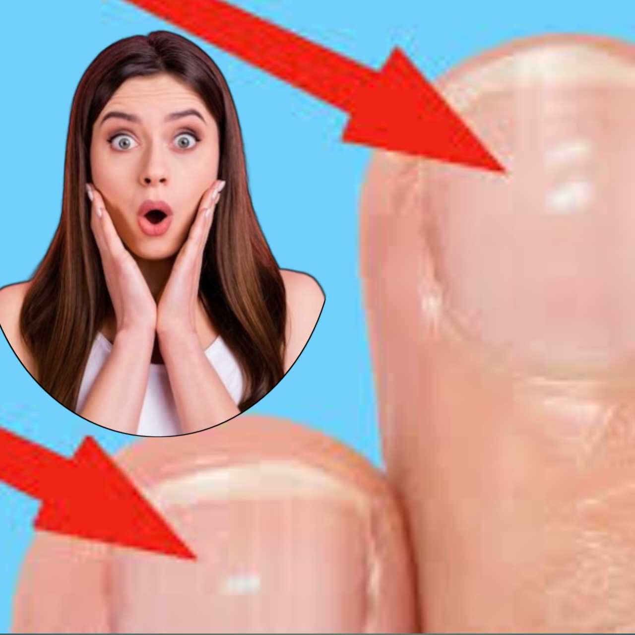 নখে সাদা–কালো দাগের ব্যাখ্যা: হস্তরেখাশাস্ত্র কী বলে?