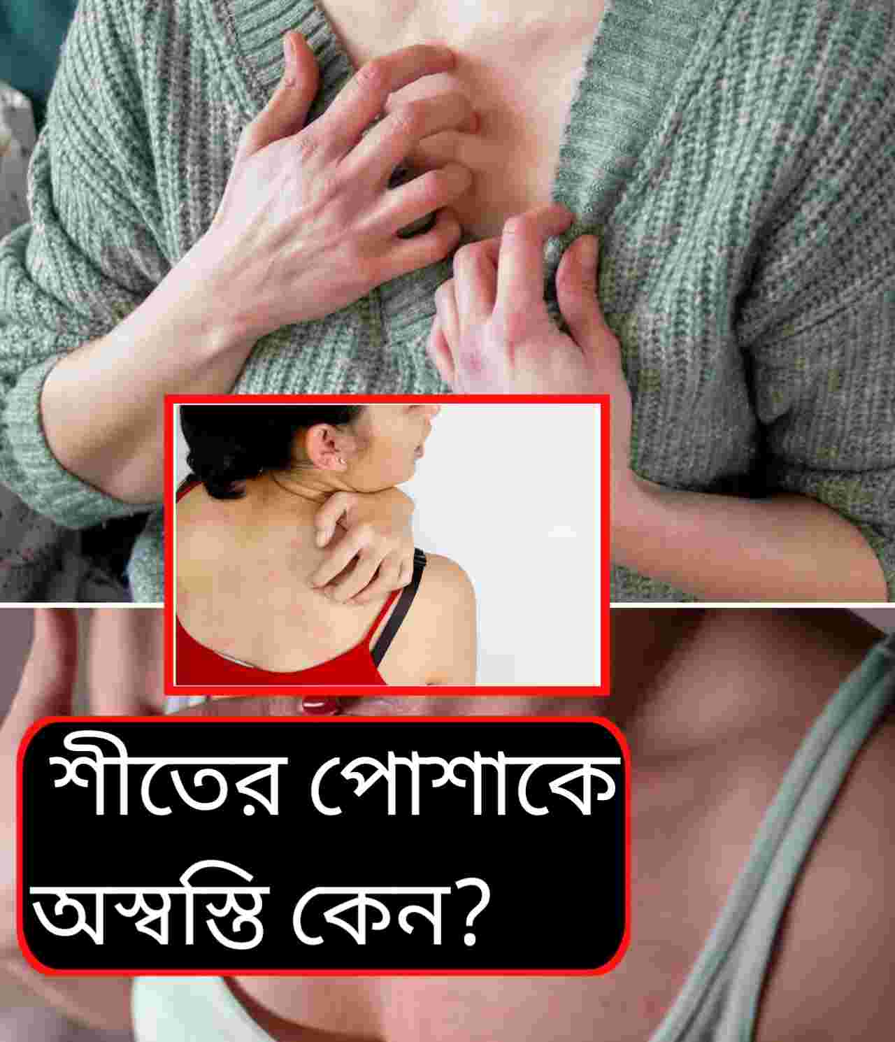 Lifestyle: সোয়েটার পরলেই চুলকানি? পশমি পোশাকে ত্বকের দফারফা কেন হয় ও বাঁচার উপায়