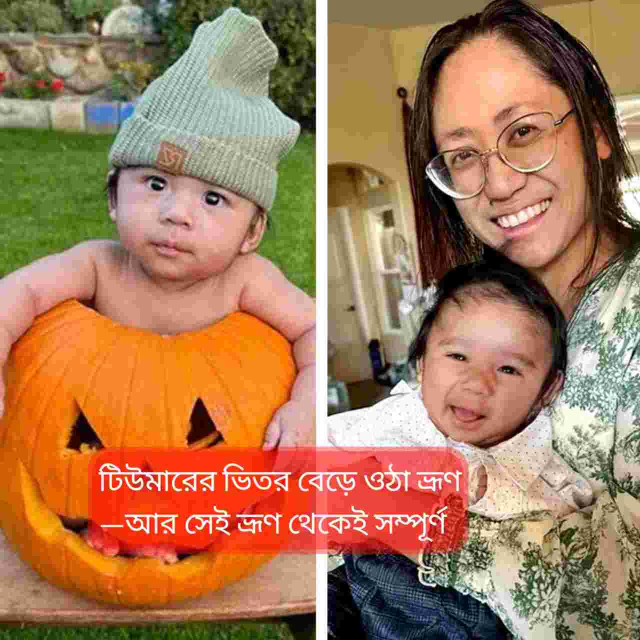 জরায়ুর বাইরে টিউমারের ভিতর বেড়ে ওঠা অলৌকিক শিশু: ক্যালিফোর্নিয়ার রিউয়ের অবিশ্বাস্য জন্মকাহিনি