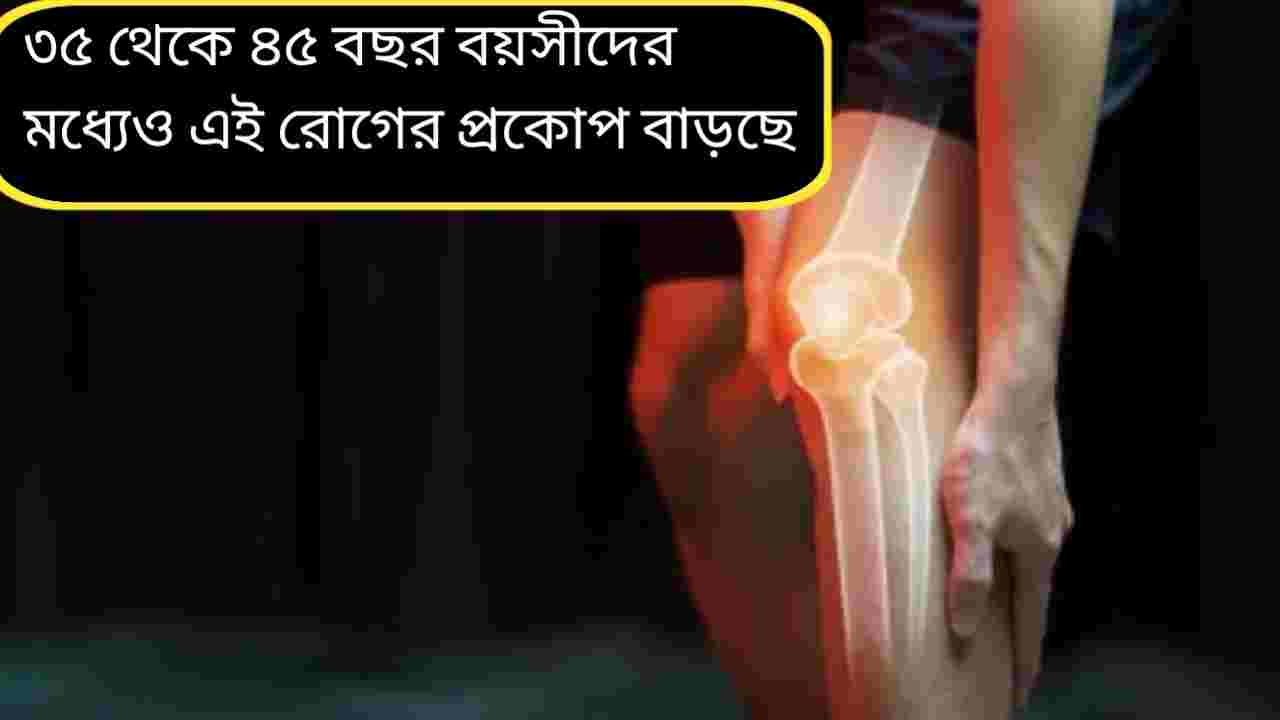 কম বয়সেই হানা দিচ্ছে অস্টিওআর্থ্রাইটিস! উপসর্গ, কারণ ও প্রতিকার এক নজরে