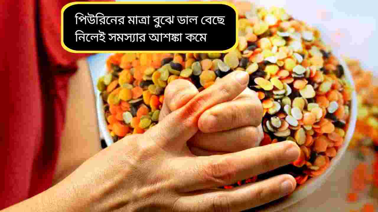 ইউরিক অ্যাসিড বাড়লে কোন ডাল নিরাপদ, কোনটি এড়াবেন? জানুন বিস্তারিত ডায়েট গাইড