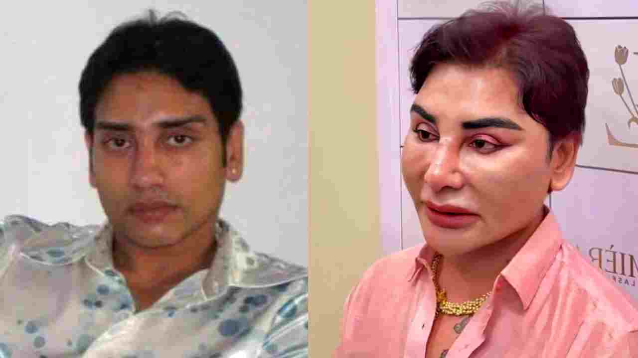 এস্থেটিক সার্জারি কি রিভার্স করা যায়? রূপবদল পছন্দ না হলে কীভাবে ফিরবেন পুরনো চেহারায়—জানালেন চিকিৎসক নৃপেন্দ্র গুহ