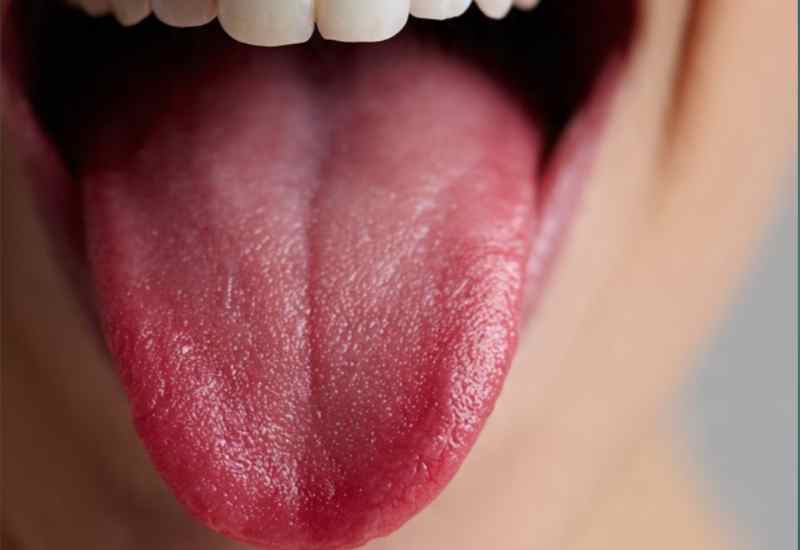 বারে বারে জল খেলেও শুকোচ্ছে জিভ? ড্রাই মাউথের কারণ, ঝুঁকি ও প্রতিকার