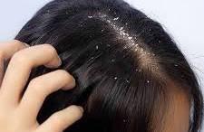 Hair Care: খুশকি বারবার ফিরে আসে কেন? কারণ জানলেই মিলবে দীর্ঘস্থায়ী সমাধান